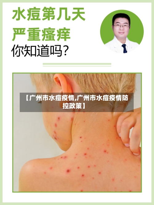 【广州市水痘疫情,广州市水痘疫情防控政策】